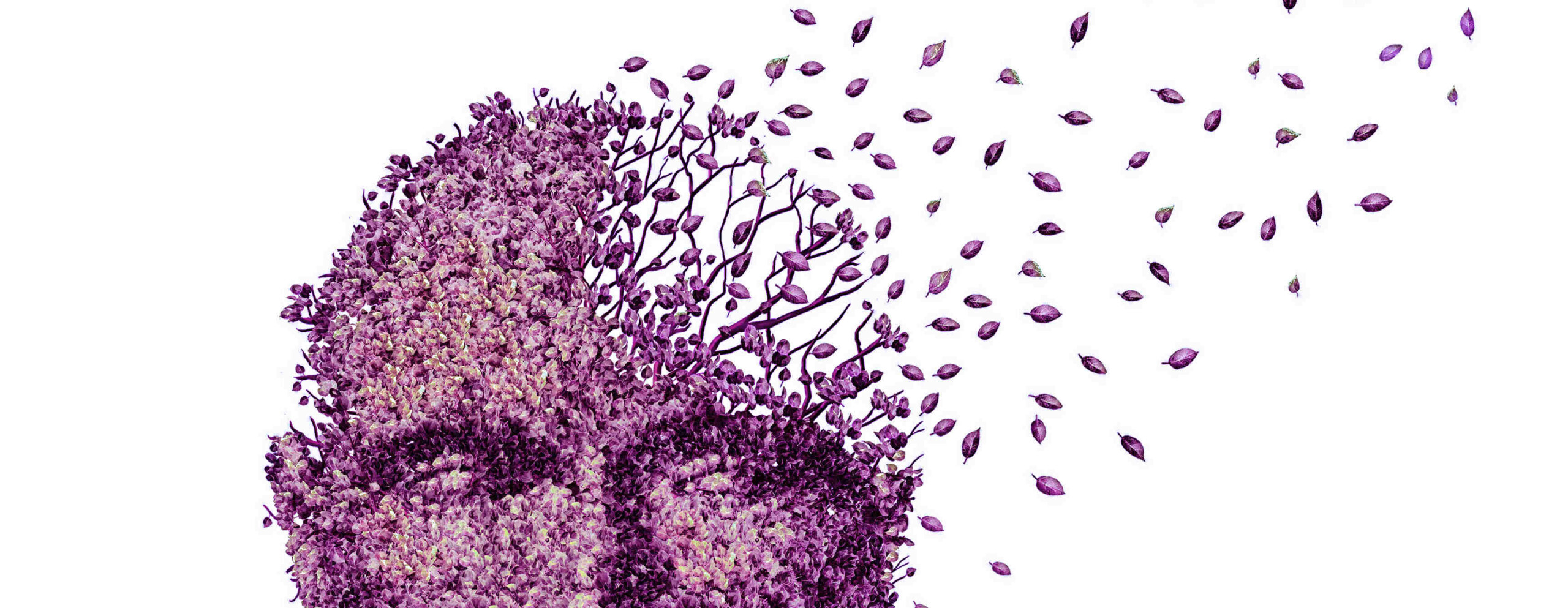 What role does nutrition play on vascular dementia?