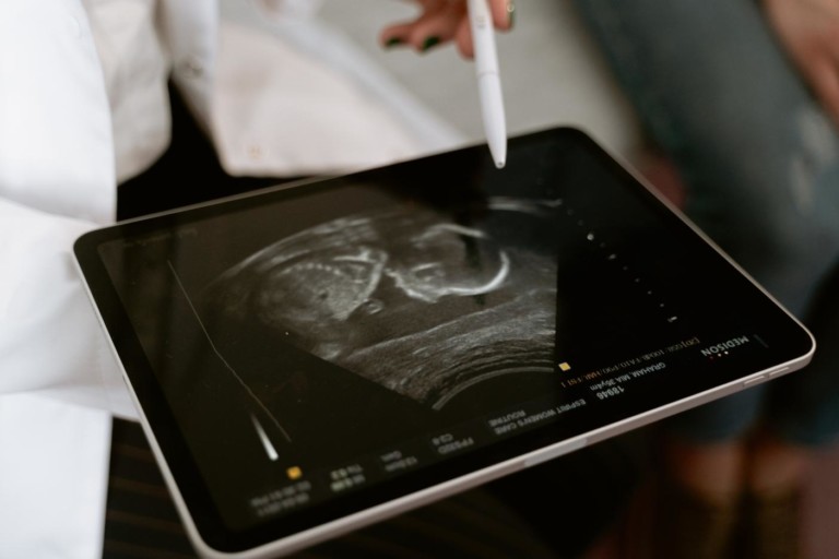 A review of social assistance programs suggest they may improve pregnancy outcomes