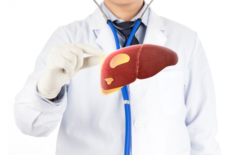 Study links sugar-sweetened beverage consumption with liver cancer