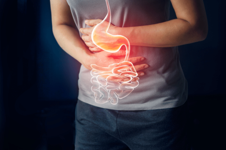 A need to re-evaluate dietary recommendations for management of inflammatory bowel disease